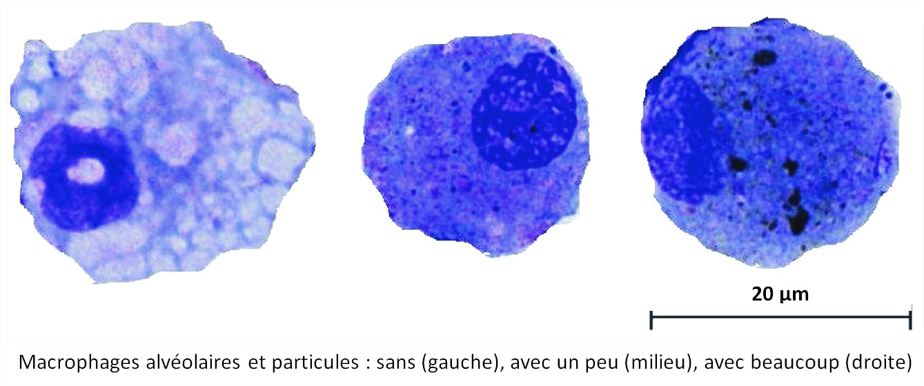 pollution air particules